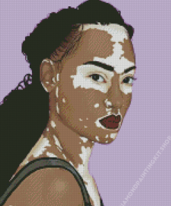 Vitiligo Woman Art Diamond Painting